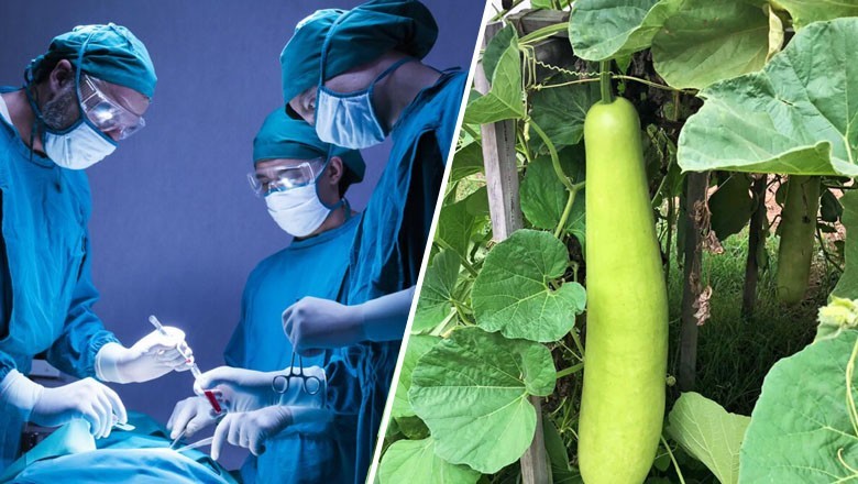 Doctors remove 16-inch long 'bottle gourd' from patient's colon