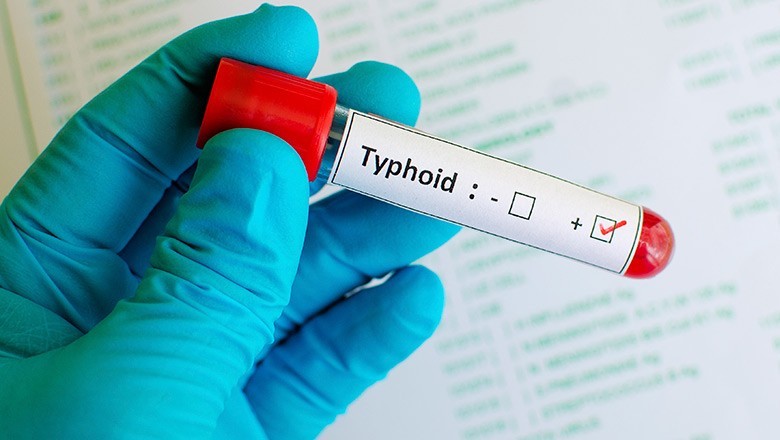 Drug-resistant XDR typhoid spreading sharply in Pakistan