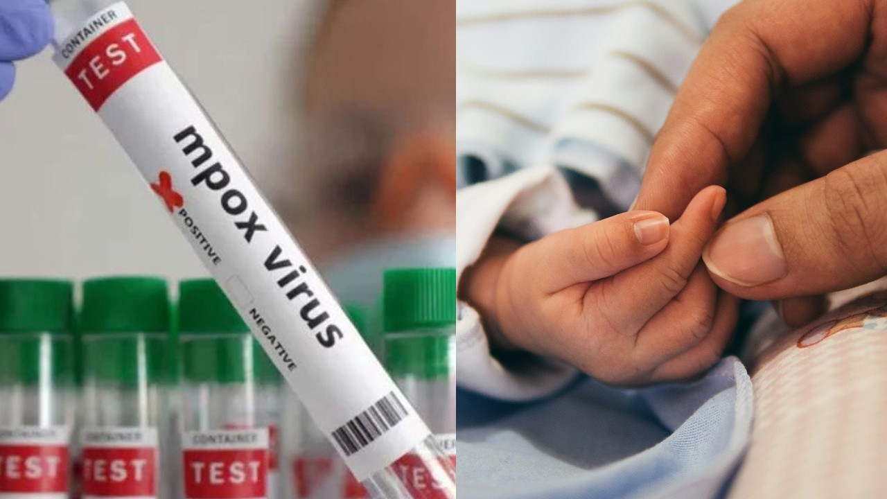 Infant tests positive for mpox in Peshawar