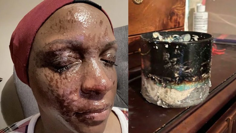 US woman files lawsuit after Bath & Body Works candle explodes in her face