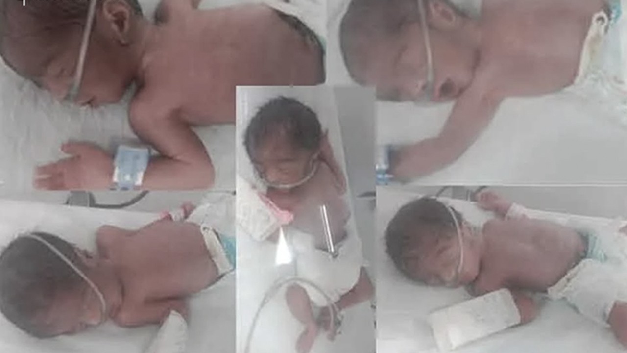 Five premature newborns die days after birth in Swabi hospital