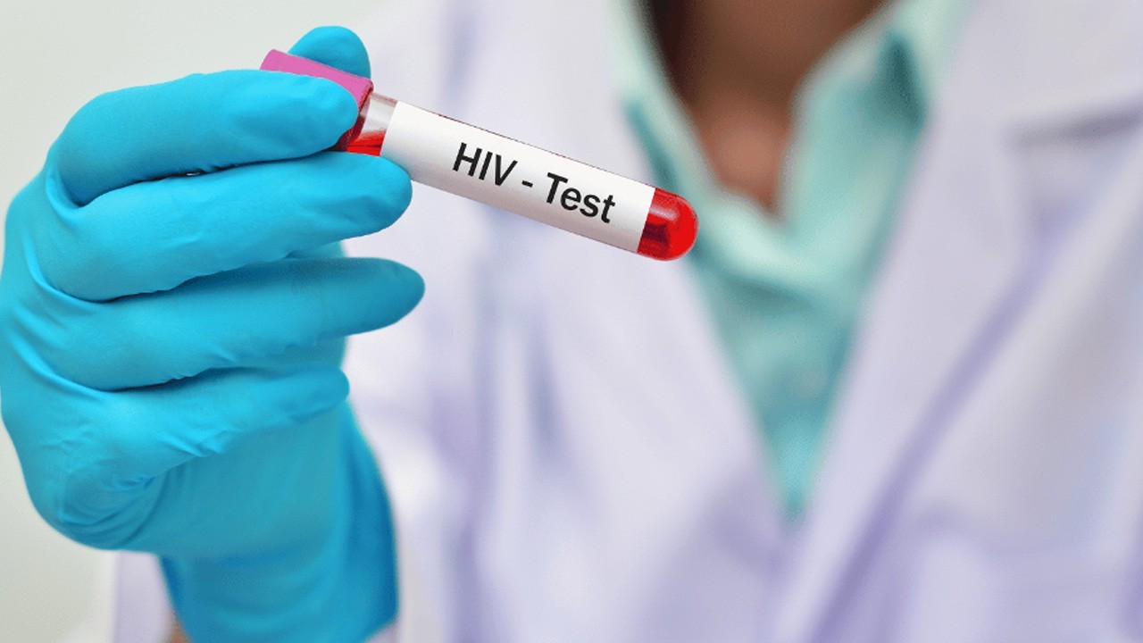 HIV test to be made mandatory before surgeries, NA panel told