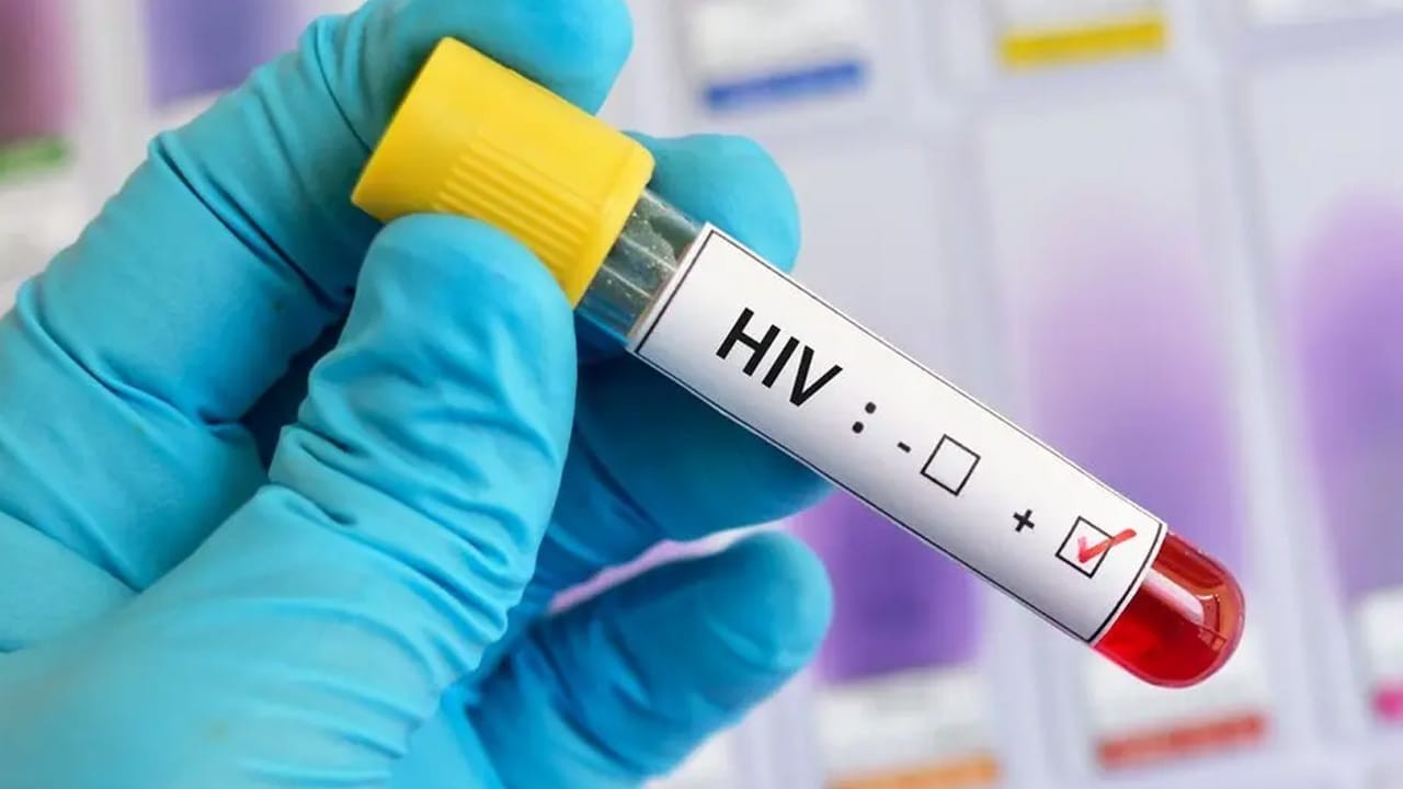 NA committee flags 20,000 untraceable HIV patients amid treatment gaps
