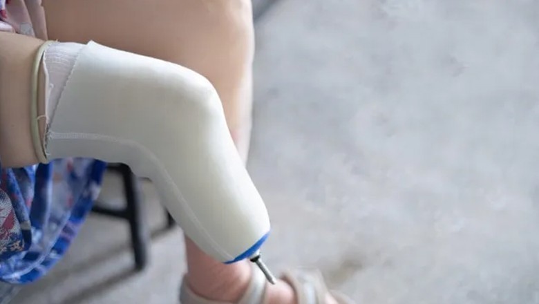 انشورنس رقم کیلیے شہری نے اپنی کی دونوں ٹانگیں کٹوا دیں