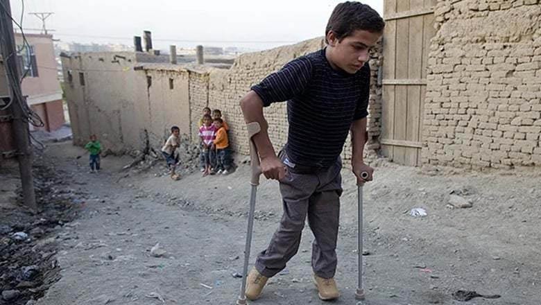 پاکستان میں 2024 کا پہلا پولیو کیس سامنے آگیا