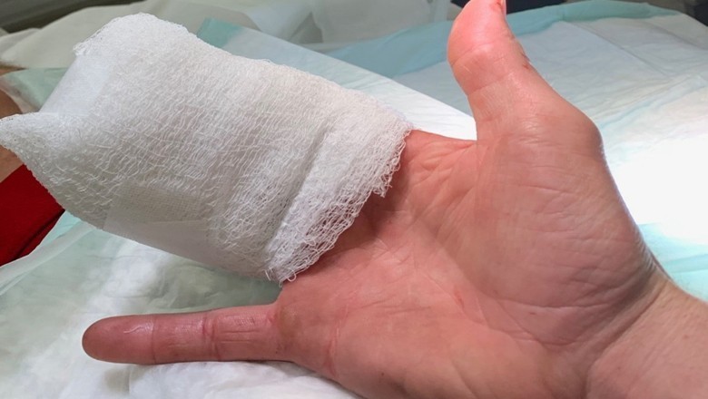 تنخواہ کے تقاضے پر سفاک مالک نے محنت کش کی چار انگلیاں کاٹ دیں