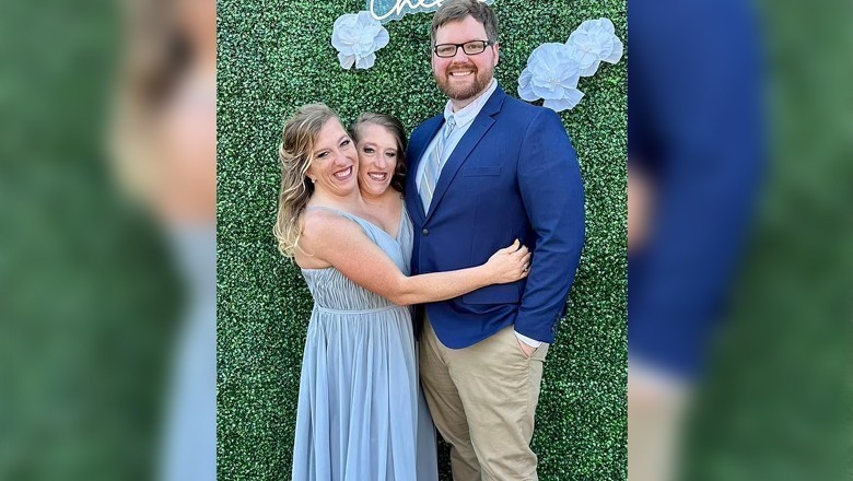 دھڑ جڑی بہنوں کی ریٹائرڈ آرمی افسر سے شادی