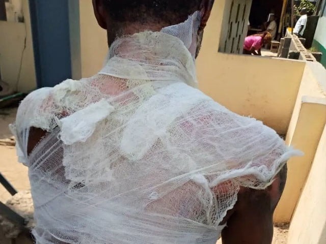 دوسری خواتین سے بات کرنے پر بیوی اور سسرالیوں کا خوفناک انتقام