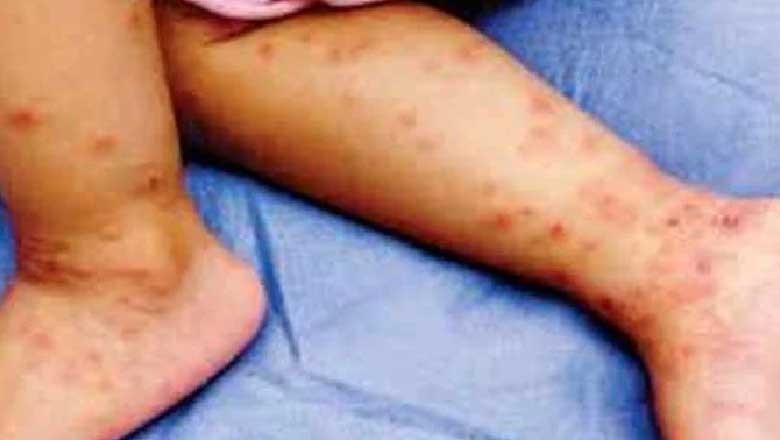 خیبرپختونخوا میں بچوں کی بڑھتی اموات پر حکومت کو ہوش آگیا