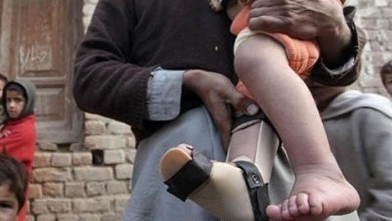 پاکستان میں رواں سال کا پولیو کا 16واں کیس رپورٹ