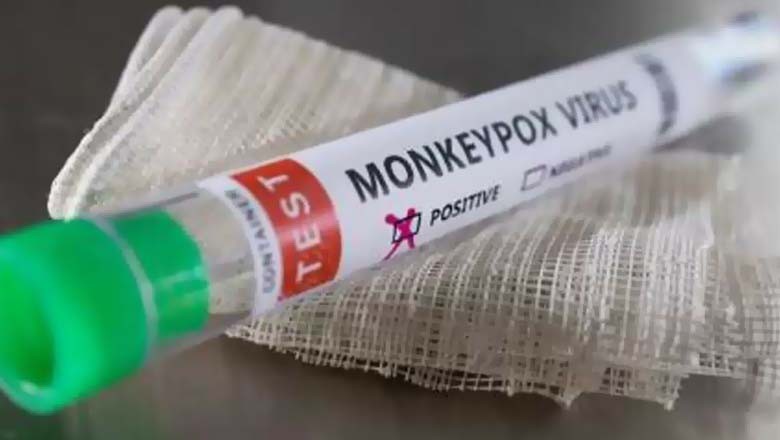 ایم پاکس الرٹ، محکمہ صحت خیبرپختونخوا نے بڑی کامیابی سمیٹ لی