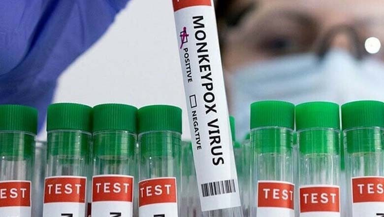 کراچی ایئرپورٹ پر ایک ہی روز میں تیسرا مشتبہ منکی پاکس کیس رپورٹ