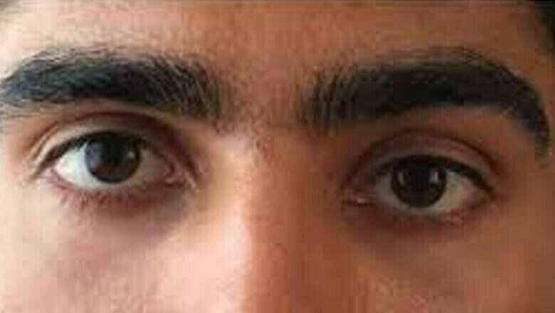 شوگر کیلیے استعمال ہونے والی عام دوا سے بینائی جانے کا انکشاف