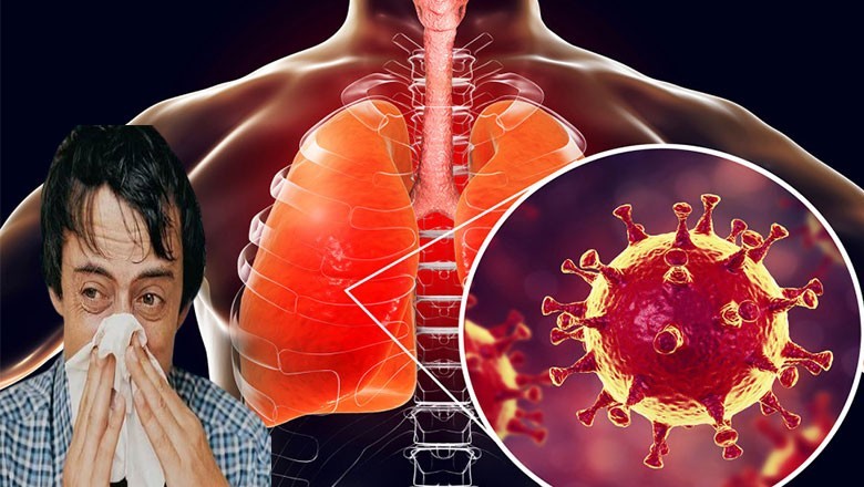 کراچی میں خطرناک بیماری پھیلنے لگی، اعداد و شمار جاری