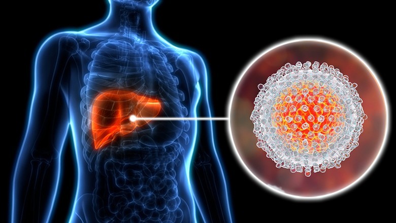 پاکستان ہیپاٹائٹس سے متاثرہ ممالک میں پہلے نمبر پر آگیا، ہوشربا رپورٹ