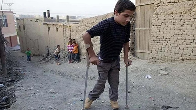 پولیو کے مزید دو کیسز رپورٹ، رواں سال کی تعداد 5 ہوگئی