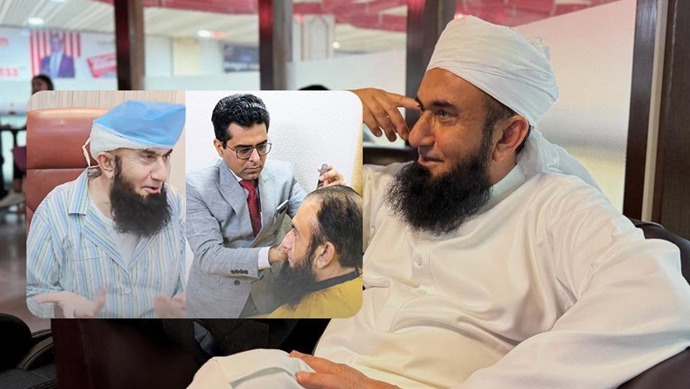 بیوی کو متاثر کرنے کیلیے ہیئر ٹرانسپلانٹ کروایا، مولانا طارق جمیل