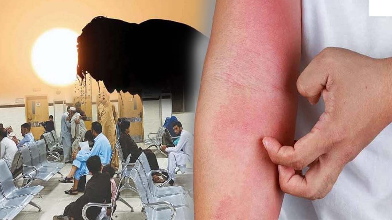 کراچی میں گرمی کی شدت میں اضافہ کے باعث امراض پھیلنے لگے
