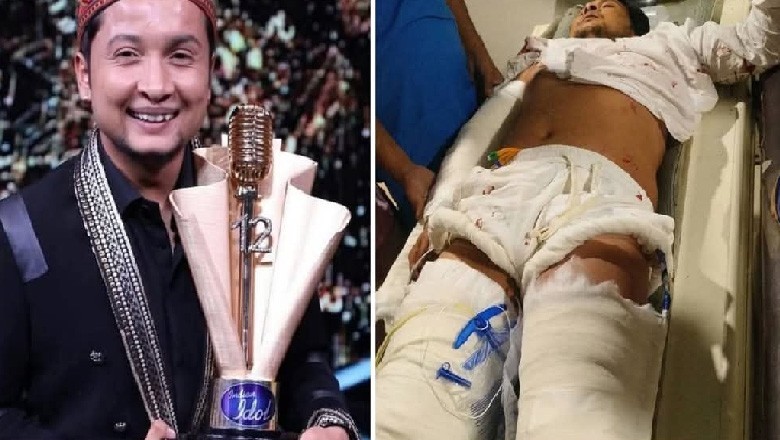 بھارتی گلوکار پوندیپ خوفناک ٹریفک حادثے کا شکار، حالت تشویشناک