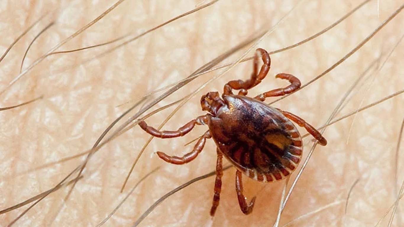 کراچی میں کانگو وائرس نے شہری کی جان لے لی