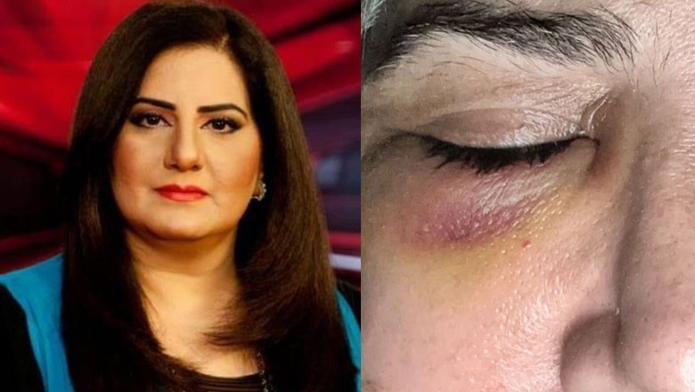 جاسمین منظور پر شوہر کا تشدد