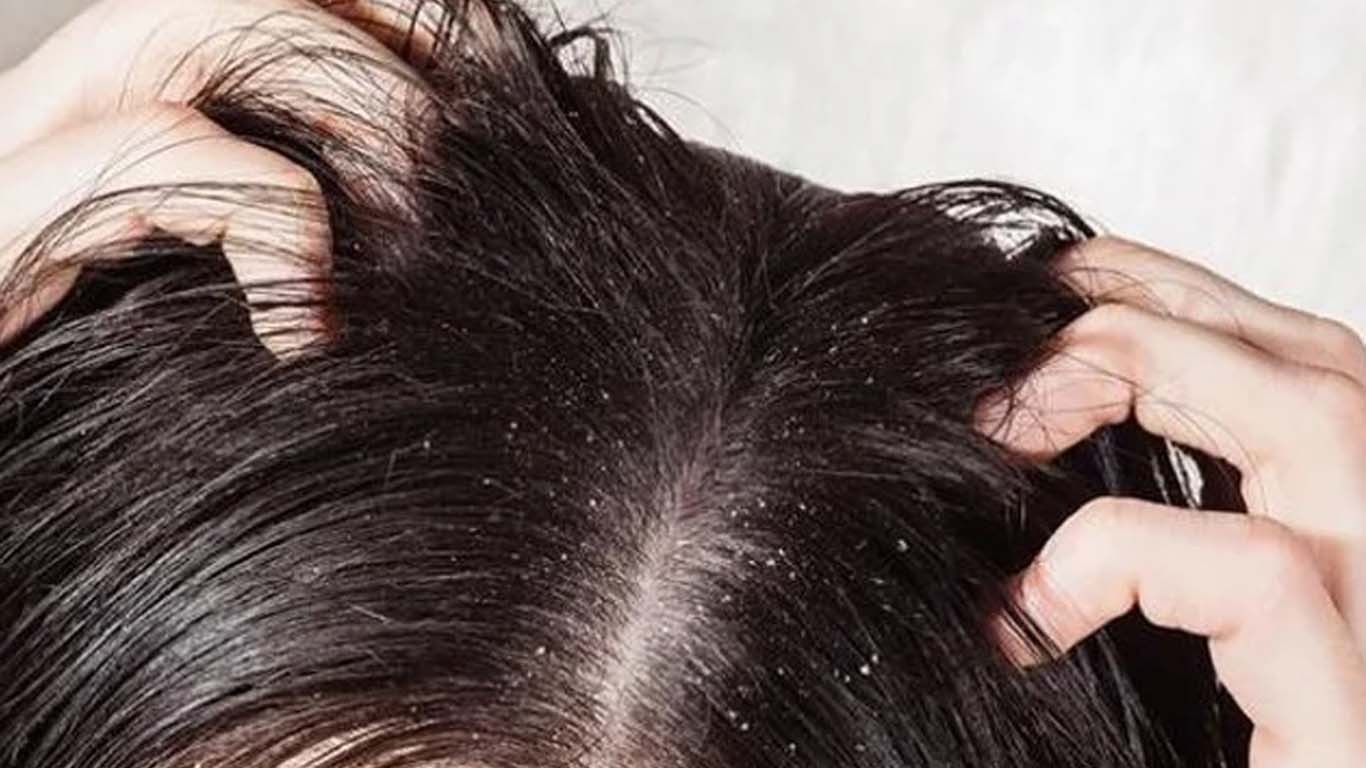 شدید جوؤں سے انفیکشن، کلاس 6 کی طالبہ ہلاک