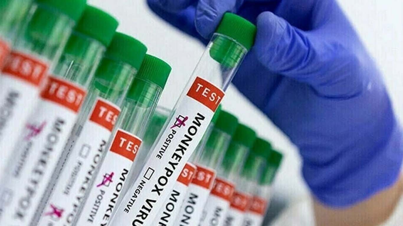 کراچی: منکی پاکس کا دوسرا کیس رپورٹ، مریض آئسولیشن منتقل