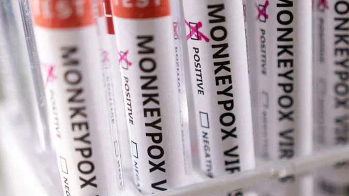 سندھ میں اب تک منکی پاکس سے 9 اموات رپورٹ