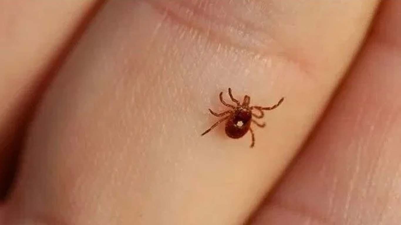 کراچی میں کانگو وائرس سے متاثر 17 سالہ نوجوان جان سے گیا