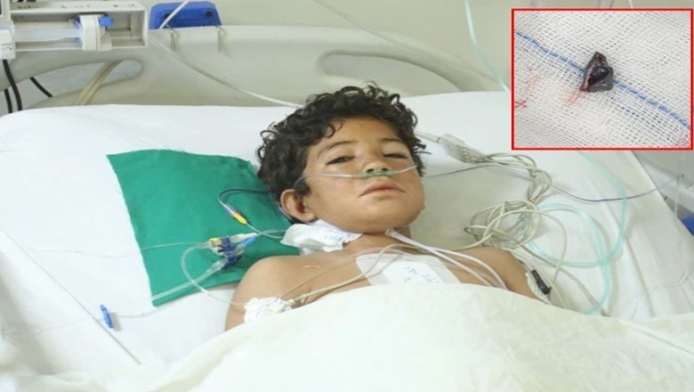 این آئی سی وی ڈی کے ڈاکٹرز کا کاررنامہ، 12 سالہ بچے کے دل میں پیوست گولی نکال کر جان بچالی